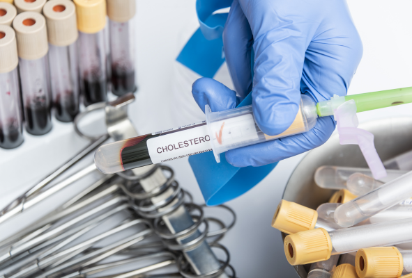 campana-de-descarte-de-dislipidemia-perfil-lipidico